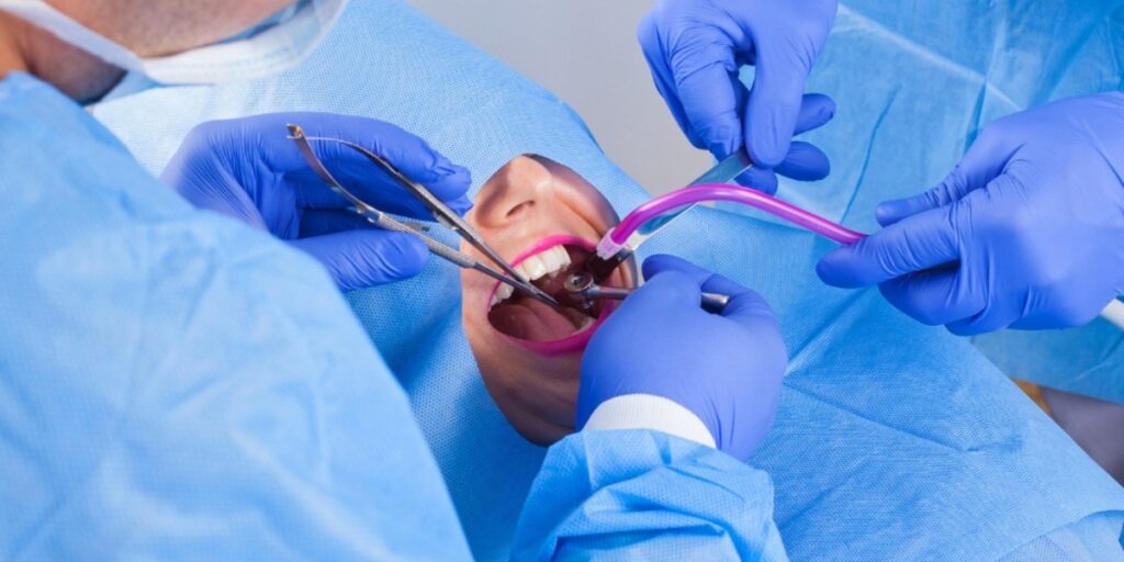 dentaspot chirurgie dentara